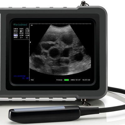 Yonker Portable Ultrasound Machine Ultrasound Machine for Animal/cattle Cow Horse Goat Use Veterinary Instrument