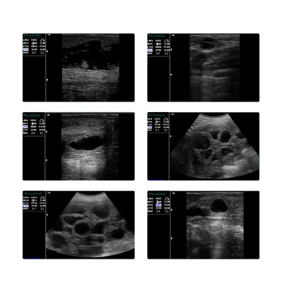 Yonker Veterinary Ultrasound Pregnancy Ultrasound Scanner for Animal Dog Vet Portable Digital Ultrasound