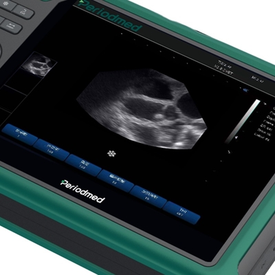 Yonker Hot Sale Ultrasound Machine Farm Use Vet Ultrasound Machine Portable Vet Veterinary Ultrasound Equipment