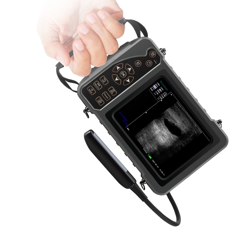 Yonker Veterinary Ultrasound Pregnancy Ultrasound Scanner for Animal Dog Vet Portable Digital Ultrasound